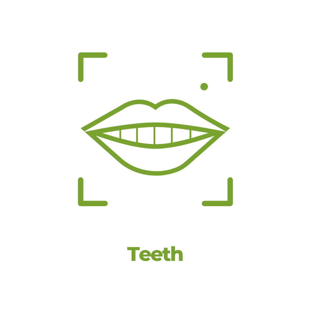 We mimic the natural imperfections of your original teeth to avoid fake-looking results.