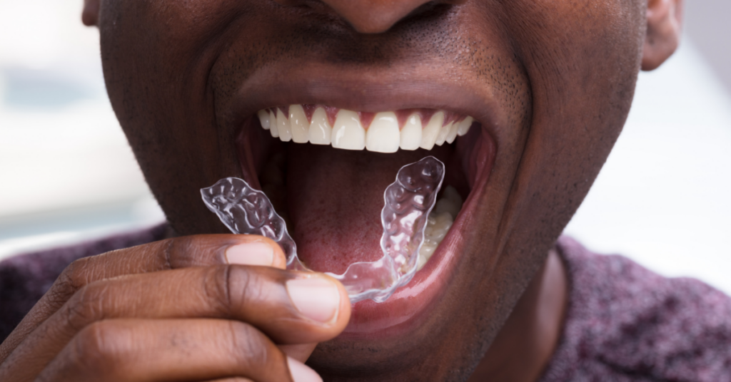Clear Aligner Therapy patient removing aligners  