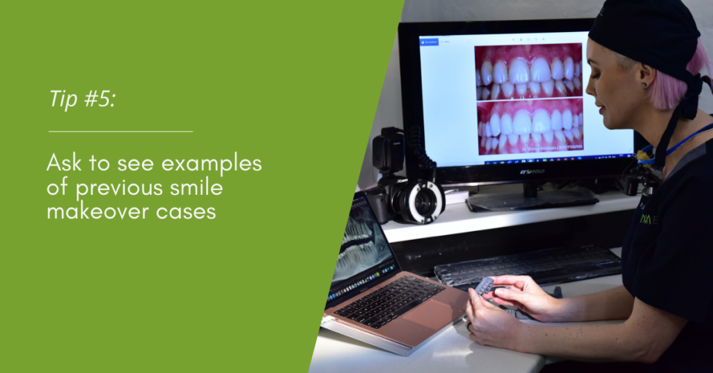 Ask to see examples of previous smile makeover cases.