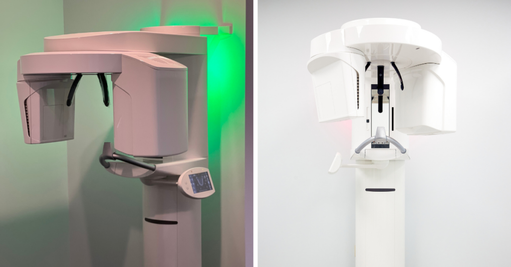 CBCT Scanners used to detect chronic oral infections