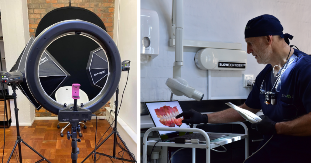 Photos, video footage and impressions from the intra oral scanner is part of the digitisation phase of a smile makeover