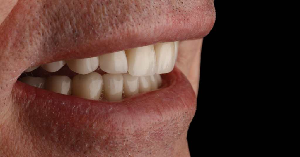 Dr Mark Bowes Cosmetic Dentist Smile Makeover