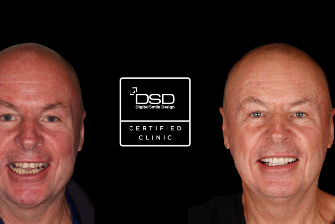 3D-Facial-Design-Dr-Mark-Bowes