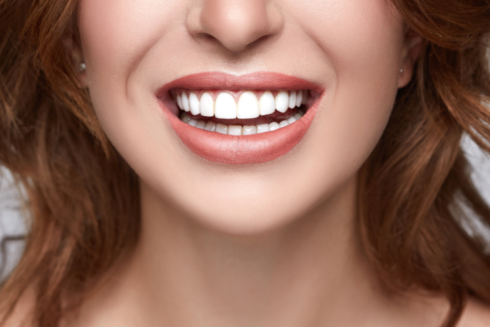 Tooth-Whitening-1