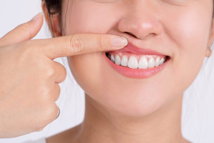 Woman,Showing,Her,Upper,Gums,With,Her,Finger,,An,Expression